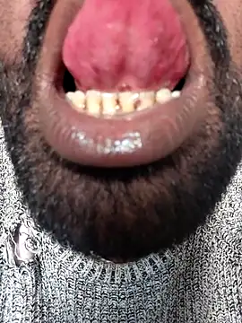 ListedLoin online show from November 18, 2025, 7:33 am